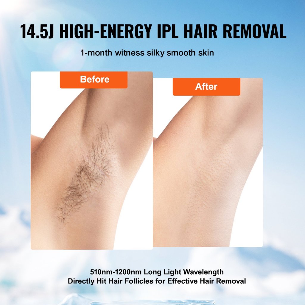 21844-9_us-ipljgtmqbdlb1gfktv2-original-img-v2-ipl-hair-remover-f2