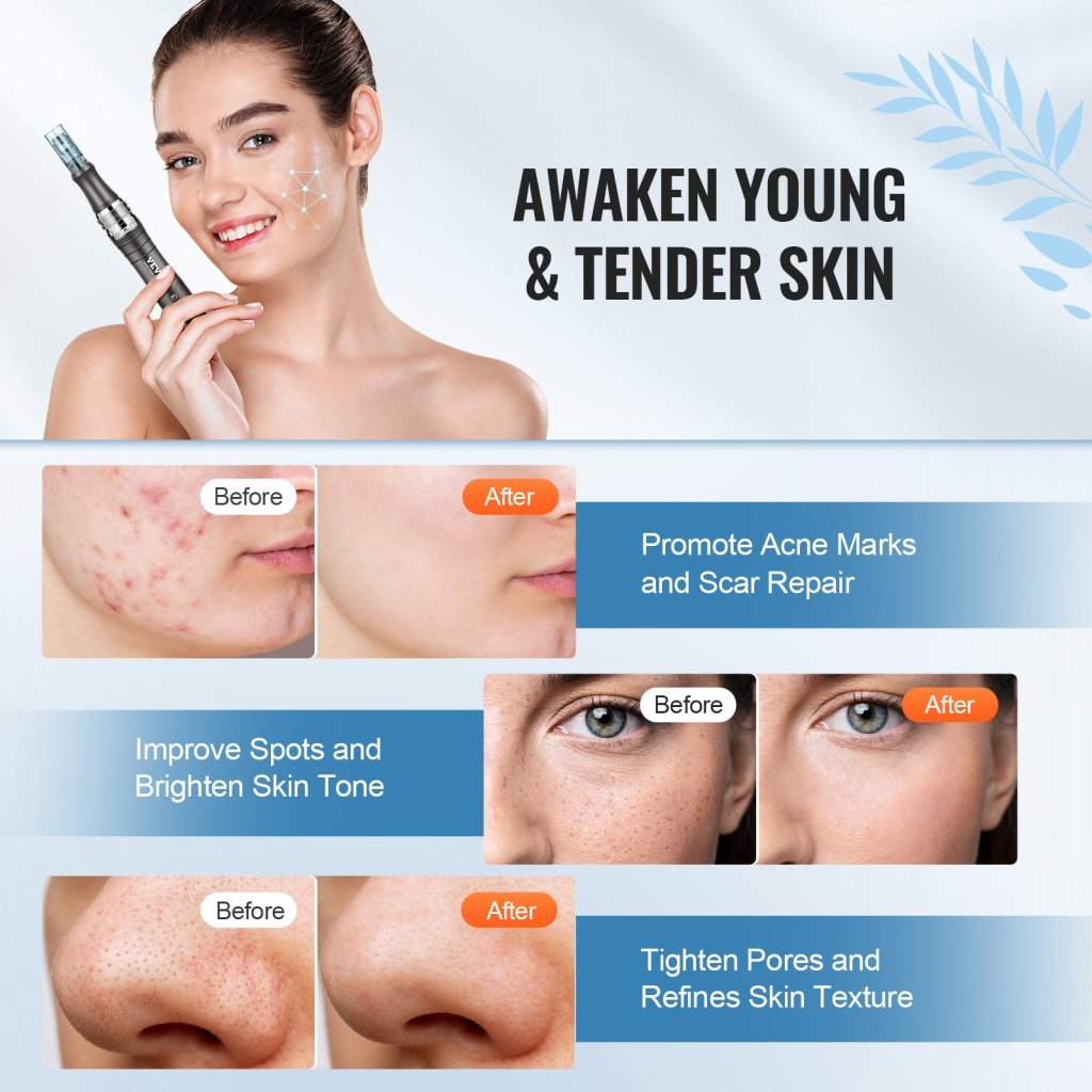 25224-6_us-nmwzkz5516p9glreav2-original-img-v1-microneedling-pen-f5